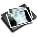 Thorax x-ray folder
